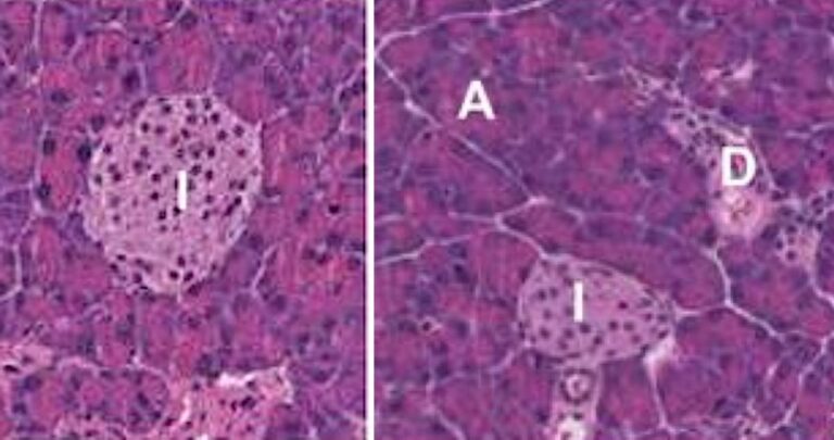 Revolutionary Cancer-Fighting Implant: Harnessing Powerful Immune Responses to Target Tumors Safely