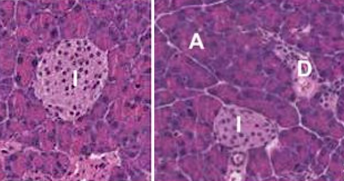 Revolutionary Cancer-Fighting Implant: Harnessing Powerful Immune Responses to Target Tumors Safely