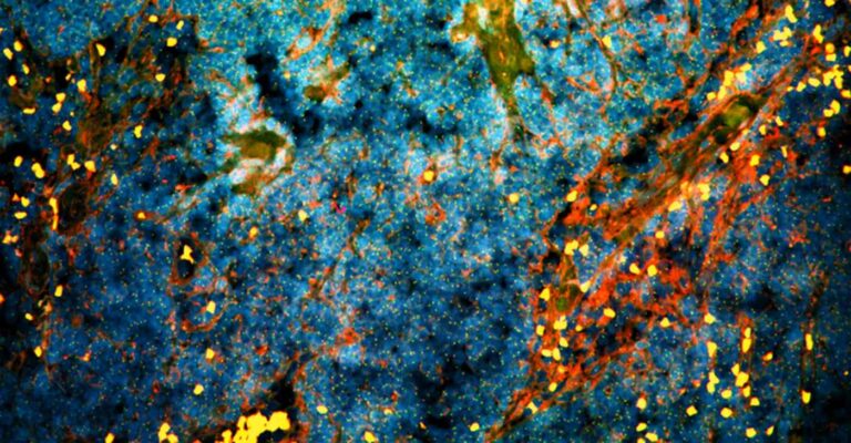 Revolutionary Supplement Triggers Self-Destruction of Prostate Cancer Cells, Say Scientists