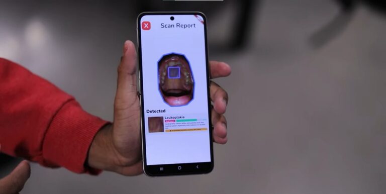 Teen Innovators Create Groundbreaking App for Early Mouth Cancer Detection, Securing $50K for Their School!