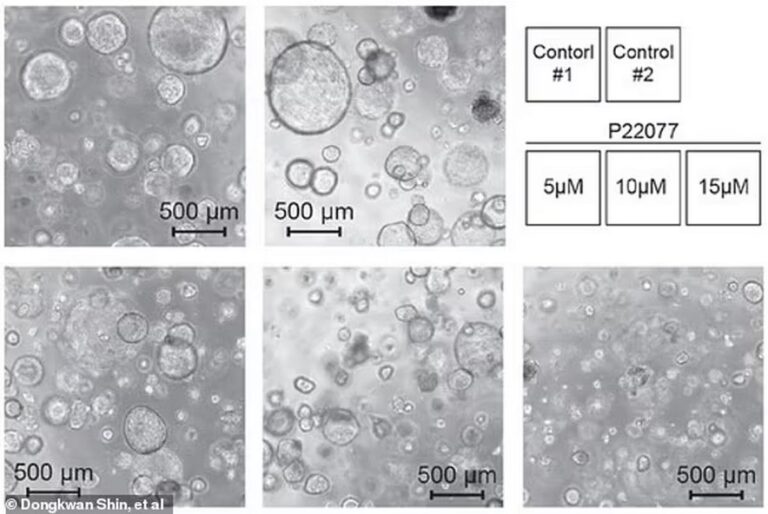 Transforming Tumor Cells: Scientists Reverse Cancer by Restoring Healthy Cell Function at a Key Moment