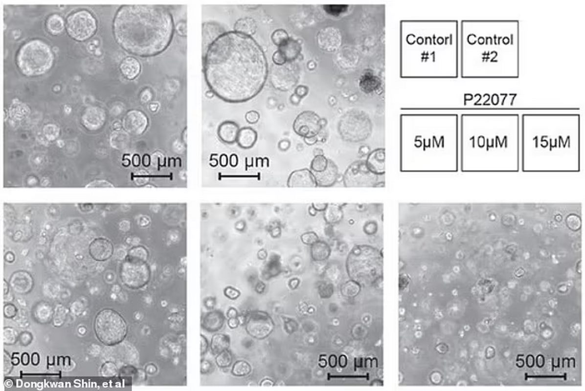 Transforming Tumor Cells: Scientists Reverse Cancer by Restoring Healthy Cell Function at a Key Moment